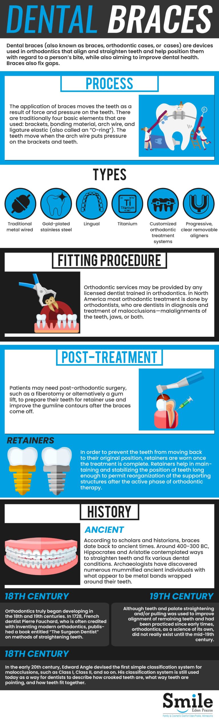 General Dentistry Concepts Dental Brace Smile Eden Prairie