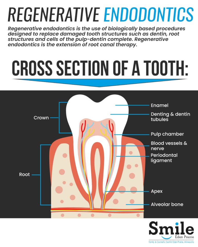General Dentistry Concepts : Restorative Endodontics | Smile Eden Prairie